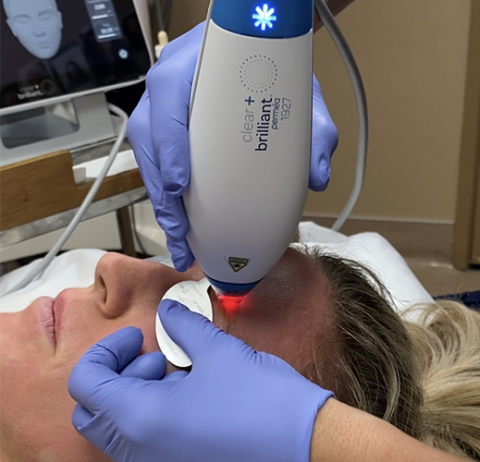 Clear + Brilliant Treatments | Laser Rejuvenation | Sacramento CA